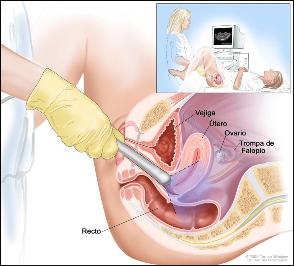 ecografia prostata transrettale